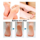 Esfoliador Eletrônico Sem Fio Para Os Pés Vivitar Pg-v011r, C