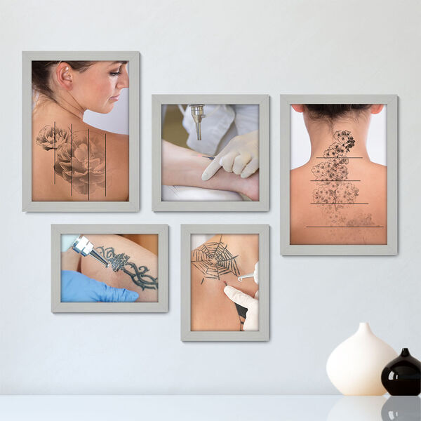 Kit Com 5 Quadros Decorativos - Remoção Tatuagem Tattoo - 131