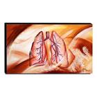 Quadro De Pintura Pulmão 60x105cm-1321