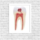 Quadro Decorativo Odontologia Anatomia Do Dente