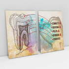 Quadro Estrutura Do Dente - Kit 2 Telas